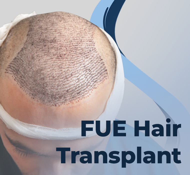 FUE Hair Transplantation